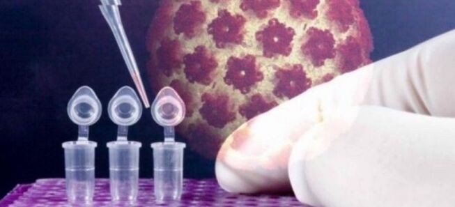 تشخيص فيروس الورم الحليمي البشري باستخدام اختبار الديجين