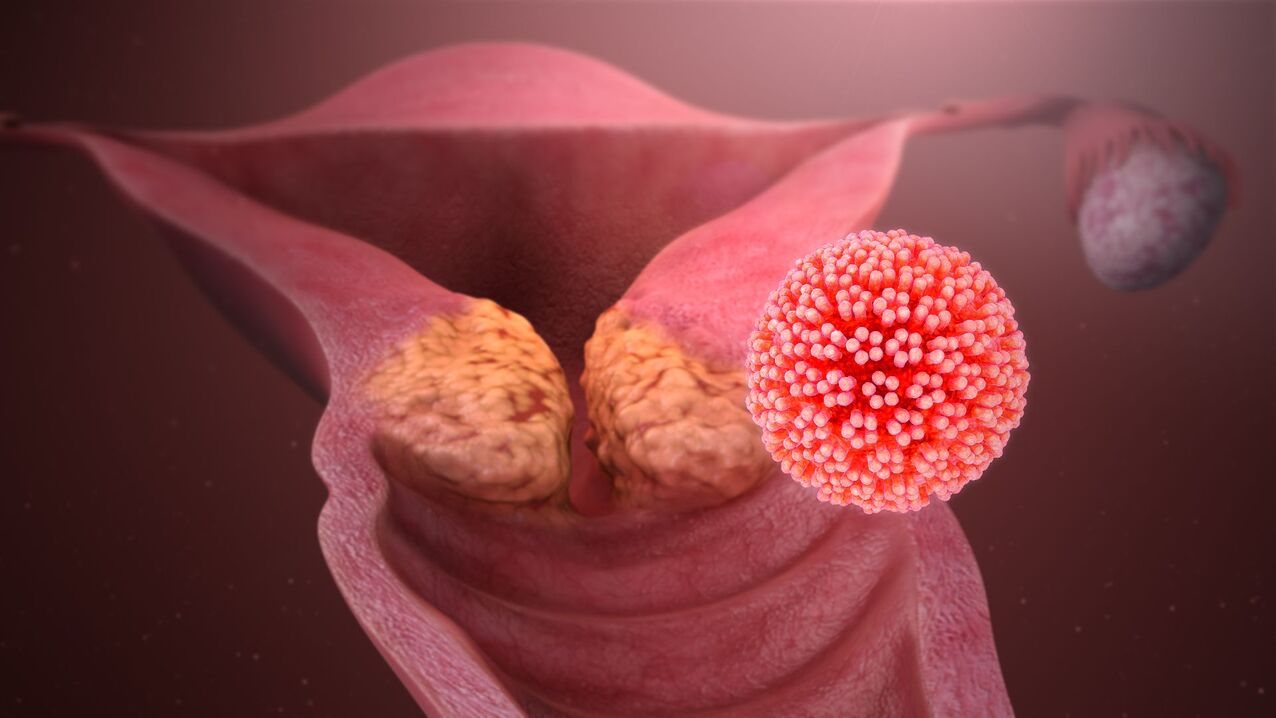 فيروس الورم الحليمي البشري في الجسم